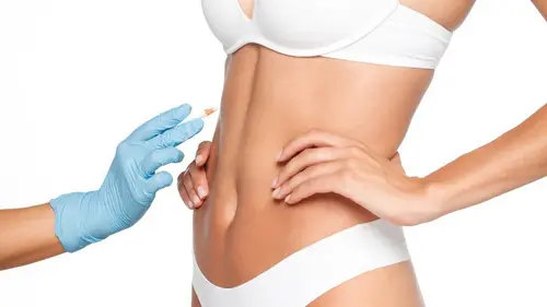 plastika po vyhĺbení